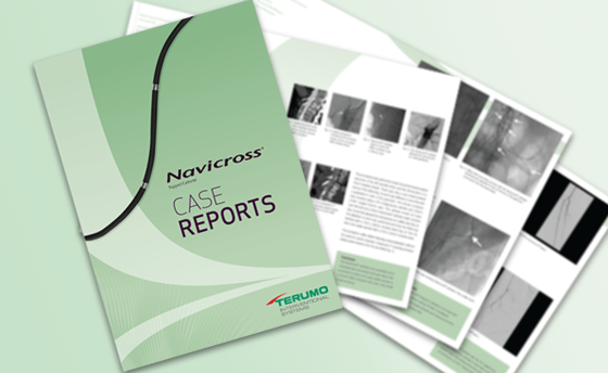 featured_tla_peripheral_case_report_navicross_560x344.png